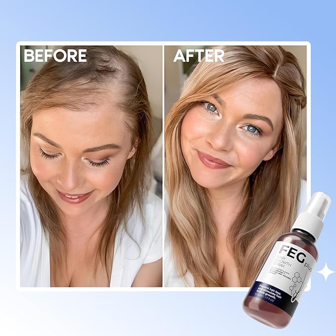 FEG Plus Hair Growth Spray (Original)