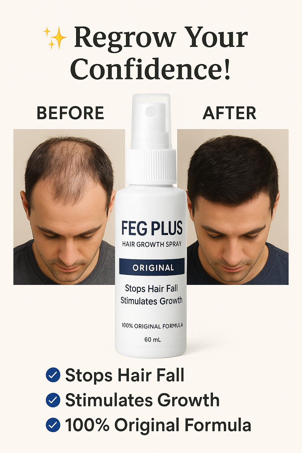 FEG Plus Hair Growth Spray (Original)